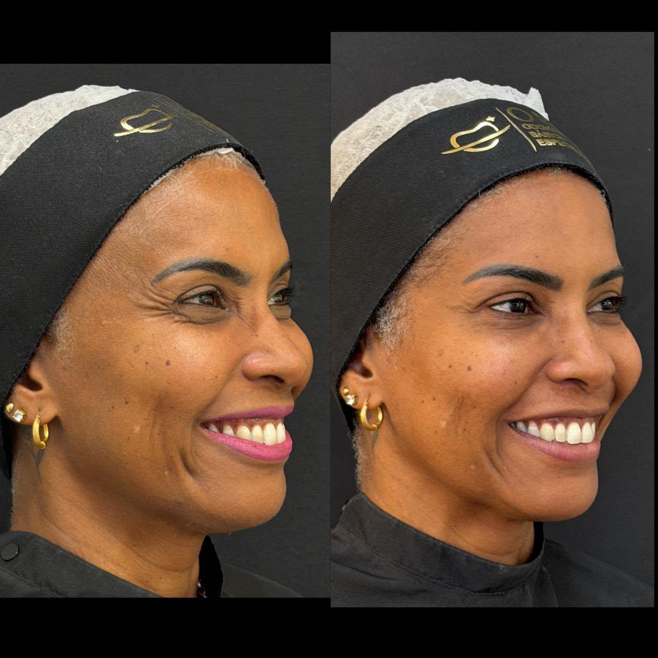 Registro comparativo de perfil e sorriso, apresentado na composição original.